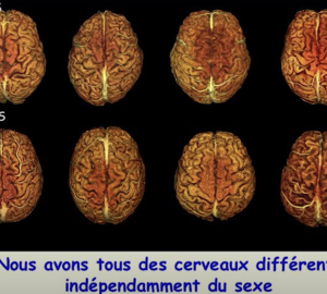 différents cerveaux